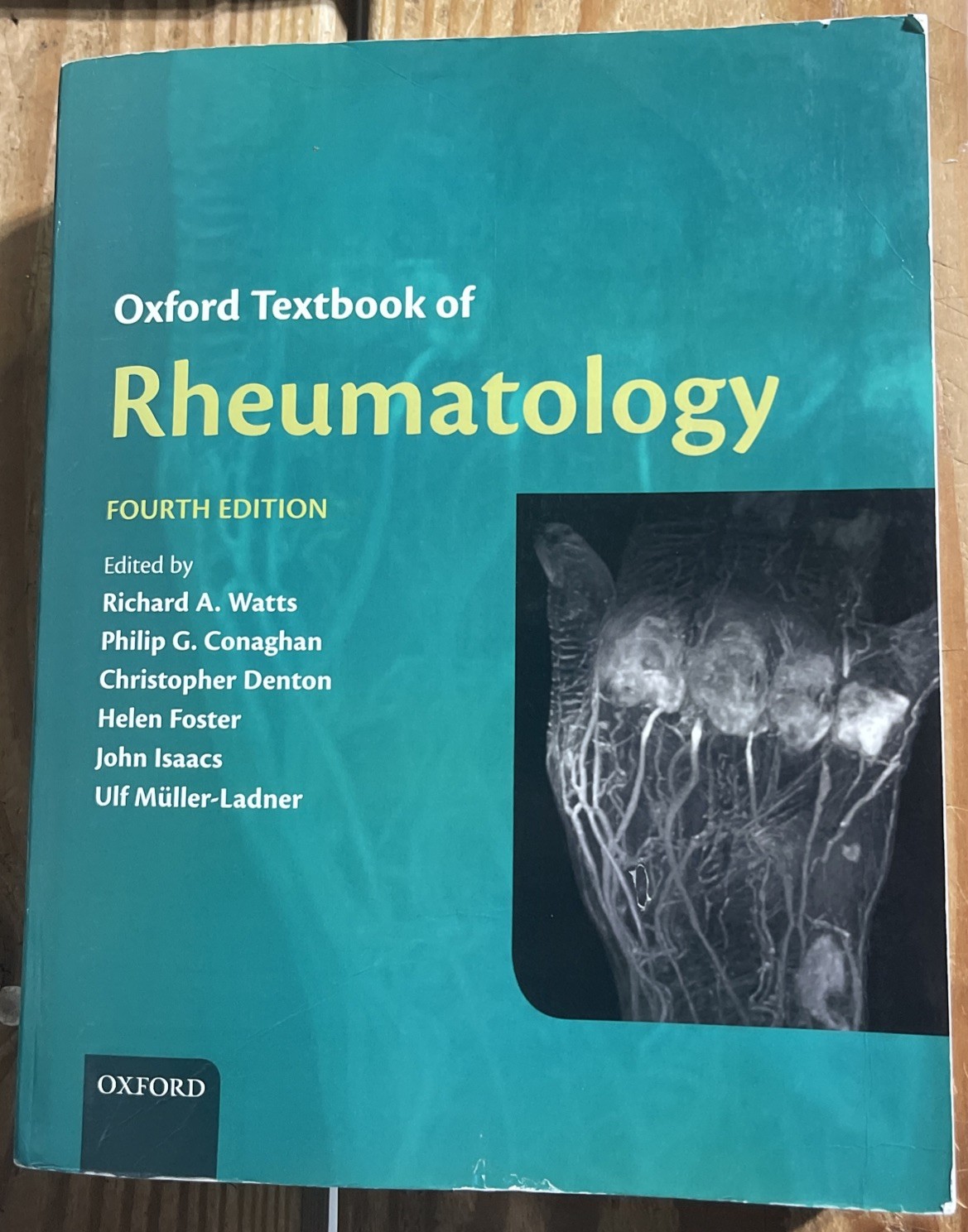 Oxford Textbook of Rheumatology by Richard A. Watts Paperback Book (4th Edition)