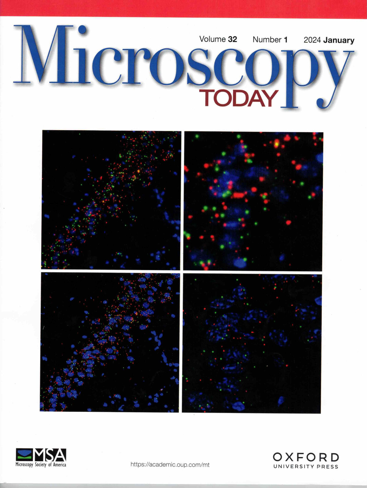Microscopy Today – January 2024 (Vol.32, No.1)