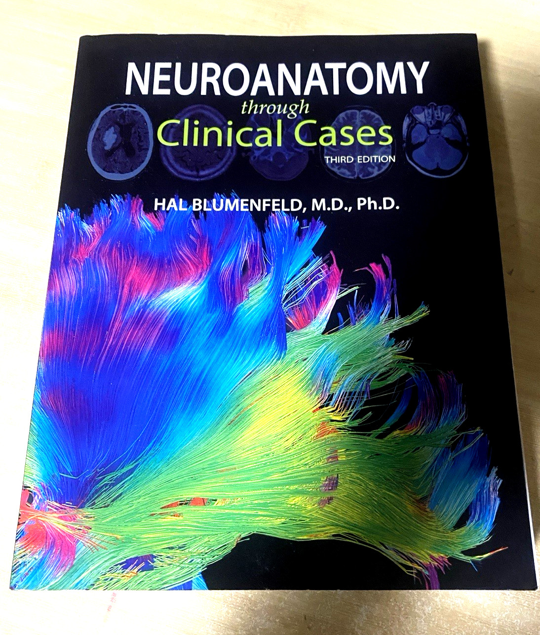 Neuroanatomy through Clinical Cases – Paperback, by Blumenfeld Hal – Good