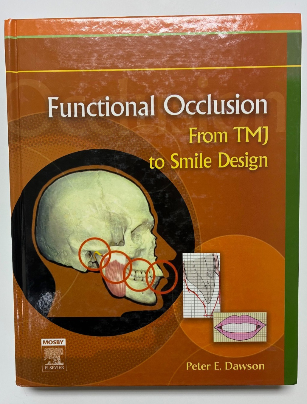 Functional Occlusion : From TMJ to Smile Design (2007, Hardcover)