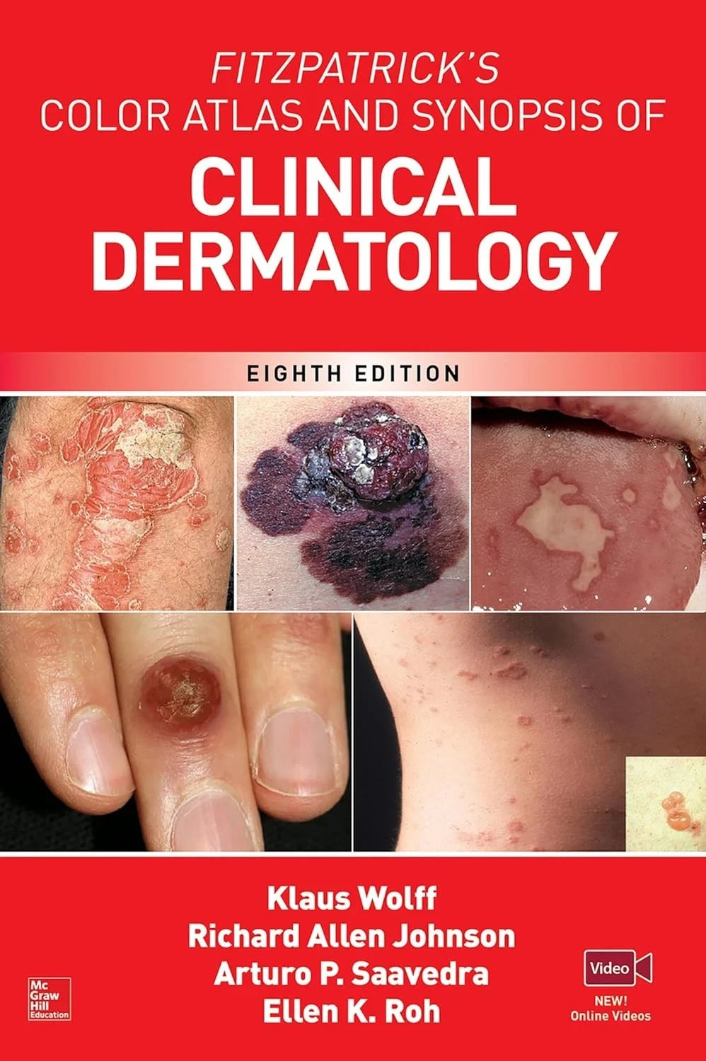 Fitzpatrick’s Color Atlas AND SYNOPSIS OF CLINICAL DERMATOLOGY, 8th Ed ,FreeShip